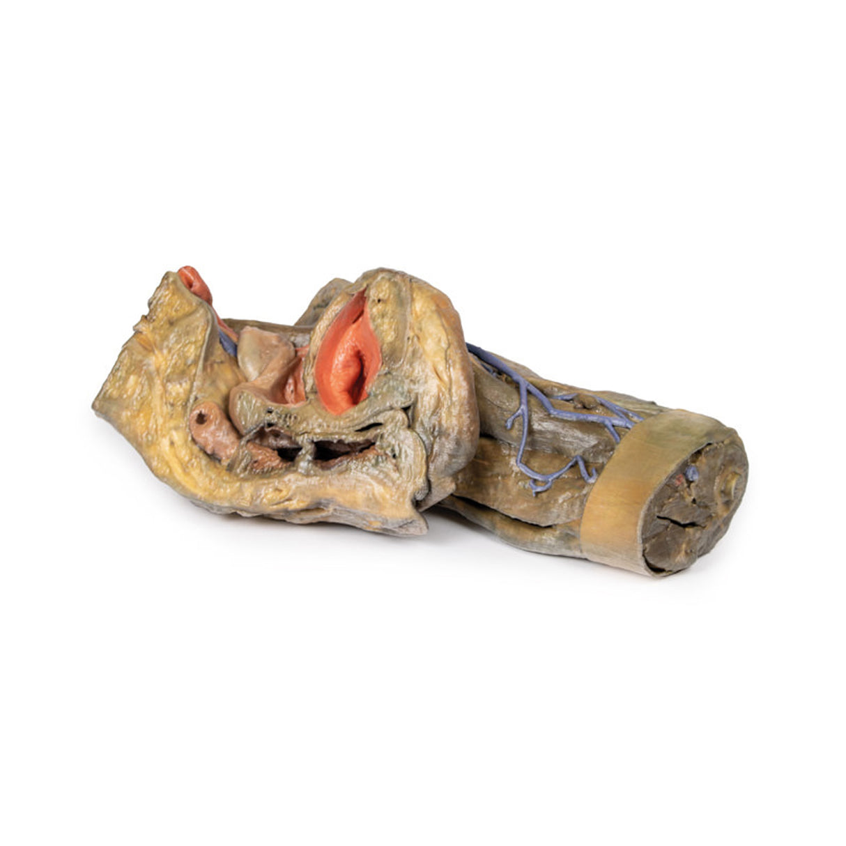 Female hemipelvis and thigh | EZ-MP1140 | Sim & Skills Ltd