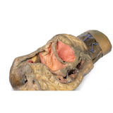 Female hemipelvis and thigh | EZ-MP1140 | Sim & Skills Ltd
