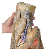 Female hemipelvis and thigh | EZ-MP1140 | Sim & Skills Ltd