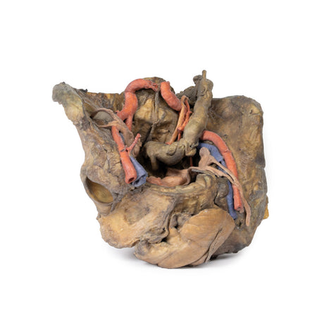 Female pelvis deep dissection | EZ-MP1141 | Sim & Skills Ltd