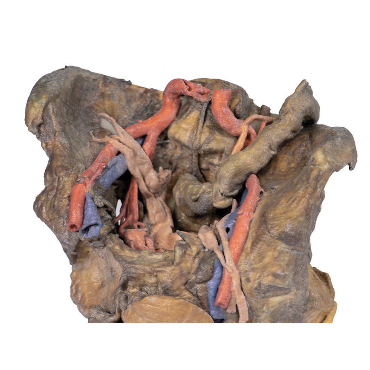 Female pelvis deep dissection | EZ-MP1141 | Sim & Skills Ltd