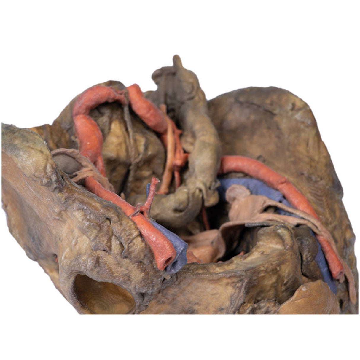 Female pelvis deep dissection | EZ-MP1141 | Sim & Skills Ltd