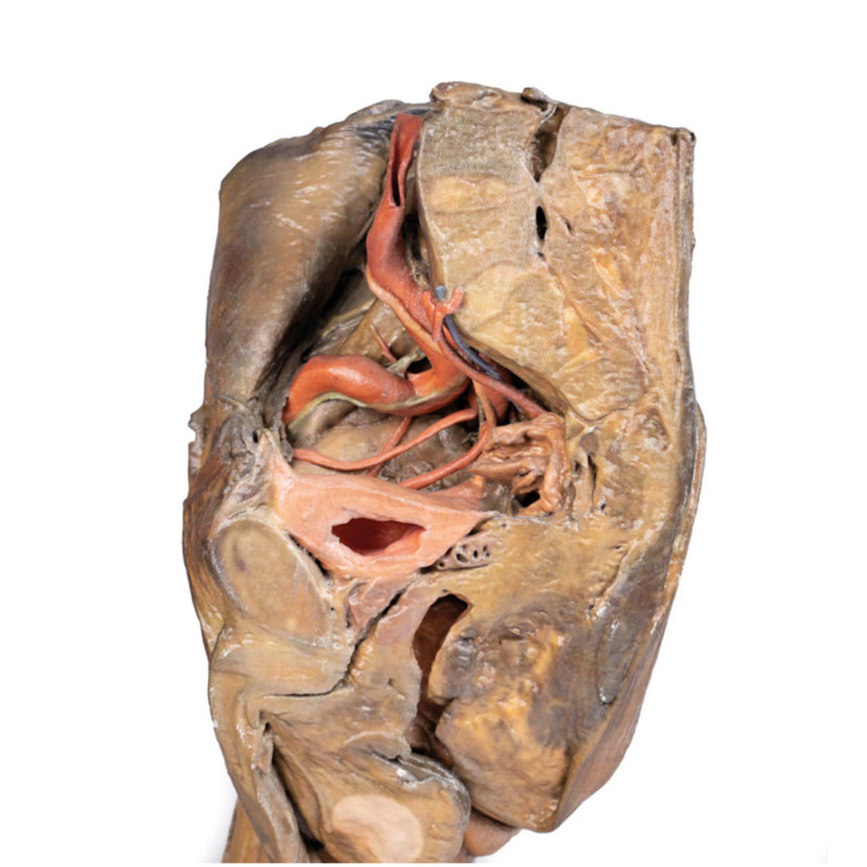 Male hemipelvis and thigh | EZ-MP1142 | Sim & Skills Ltd