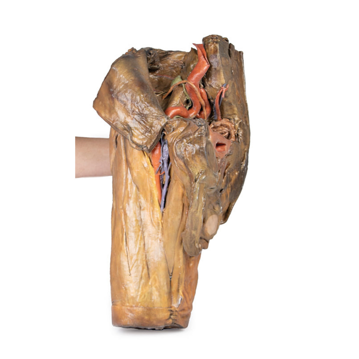 Male hemipelvis and thigh