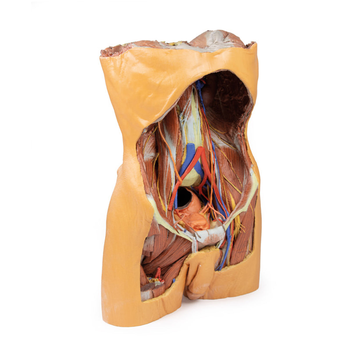 Posterior Abdominal wall | EZ-MP1300 | Sim & Skills Ltd