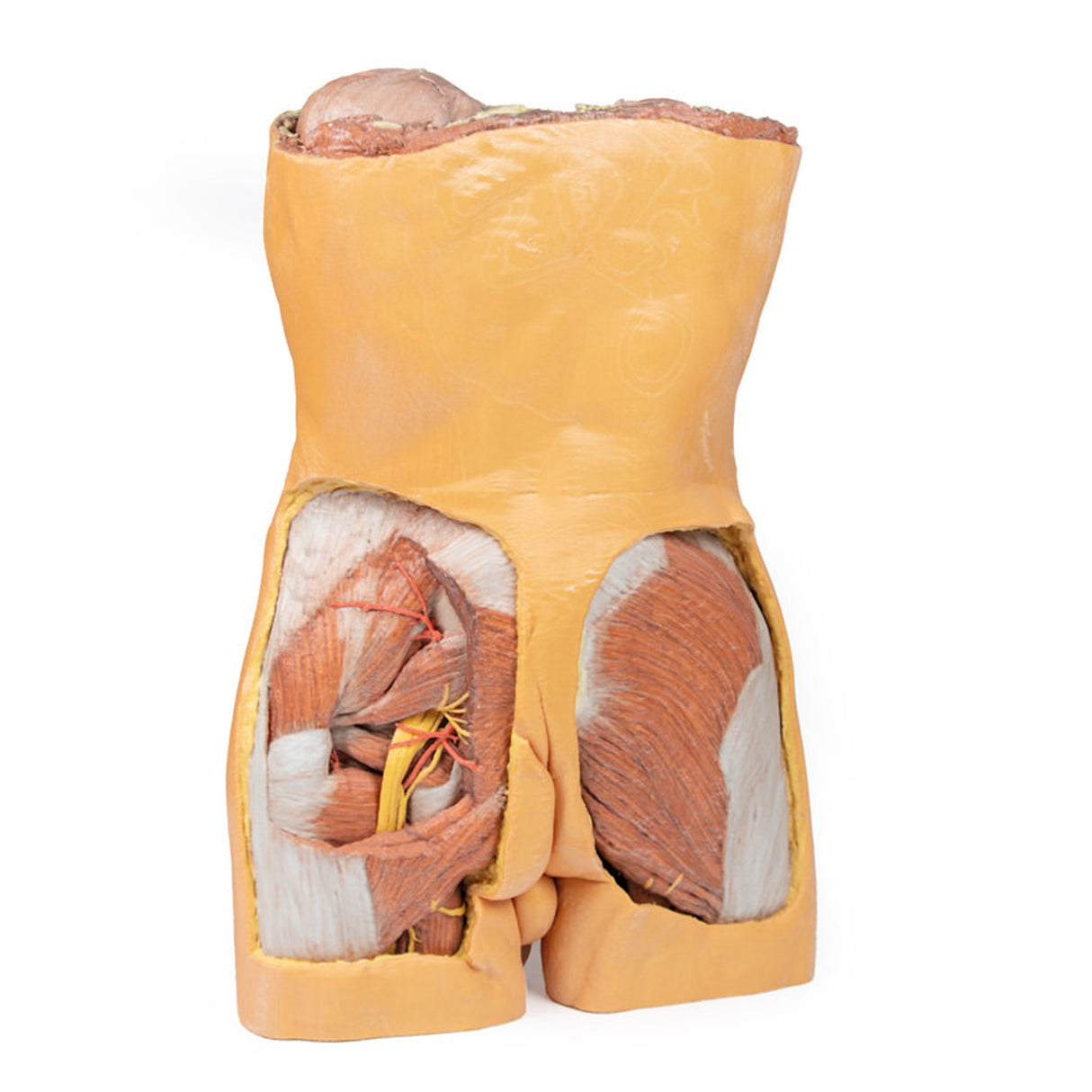 Posterior Abdominal wall | EZ-MP1300 | Sim & Skills Ltd