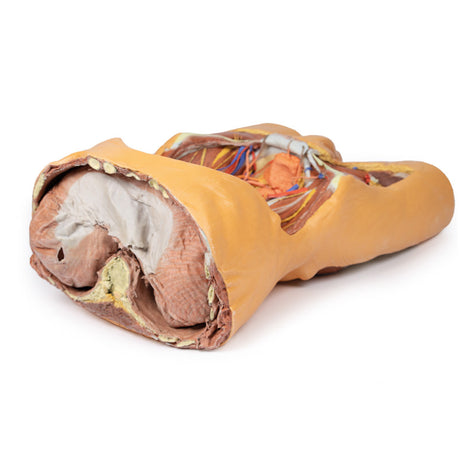 Posterior Abdominal wall | EZ-MP1300 | Sim & Skills Ltd