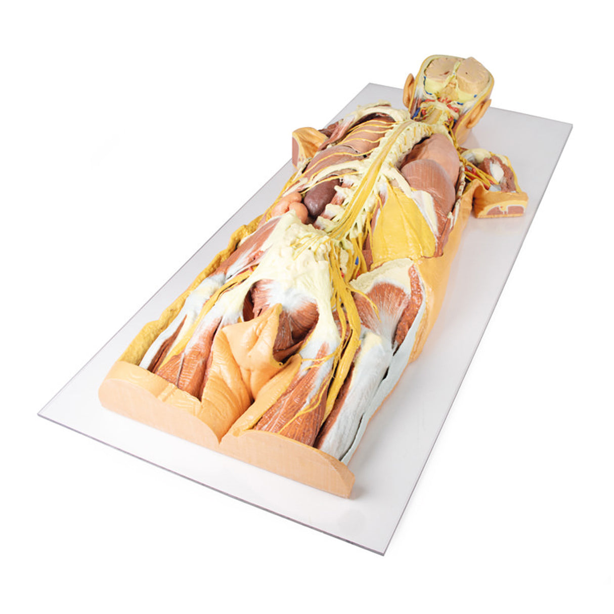 Nervous System Dissection (posterior view) | EZ-MP1400 | Sim & Skills Ltd