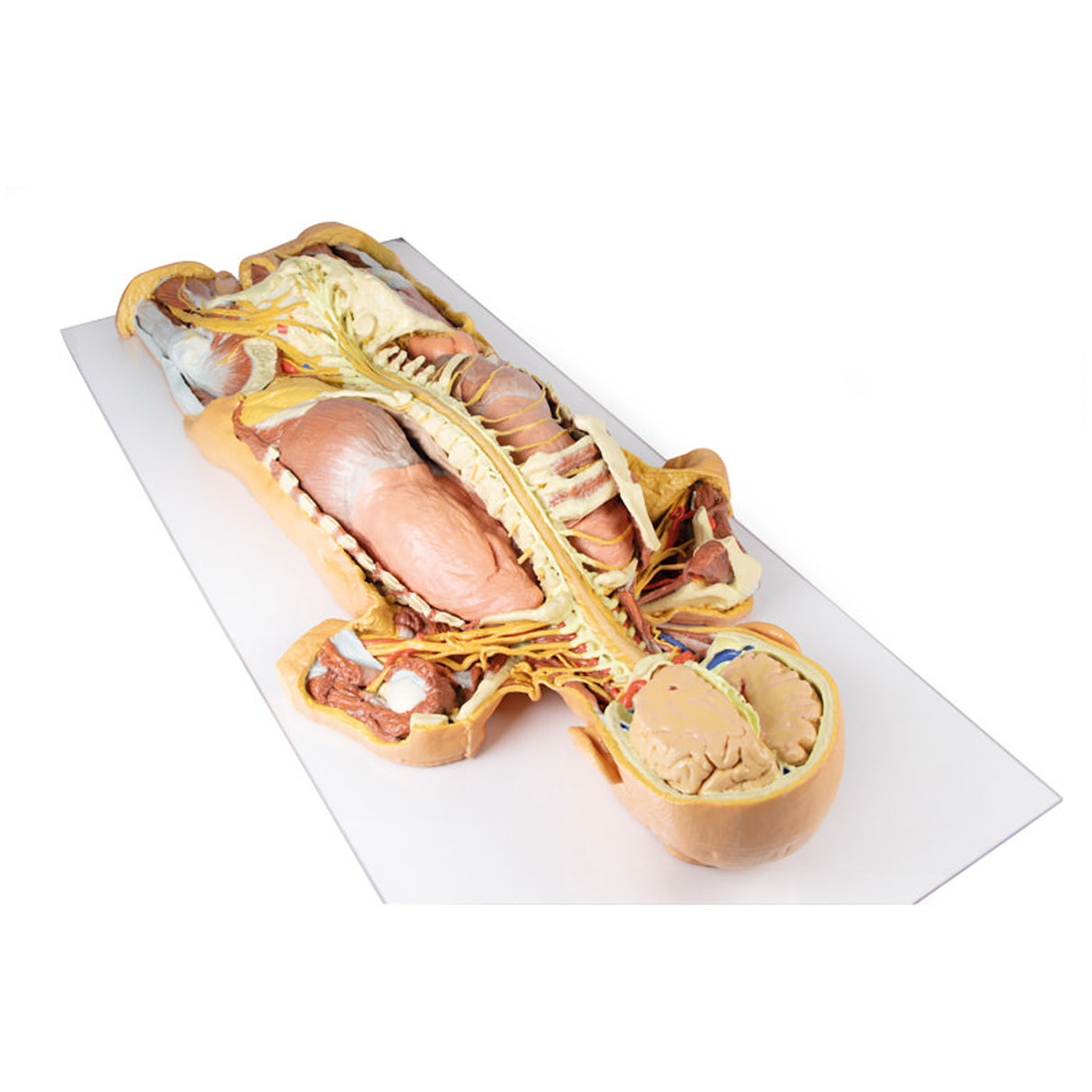 Nervous System Dissection (posterior view) | EZ-MP1400 | Sim & Skills Ltd