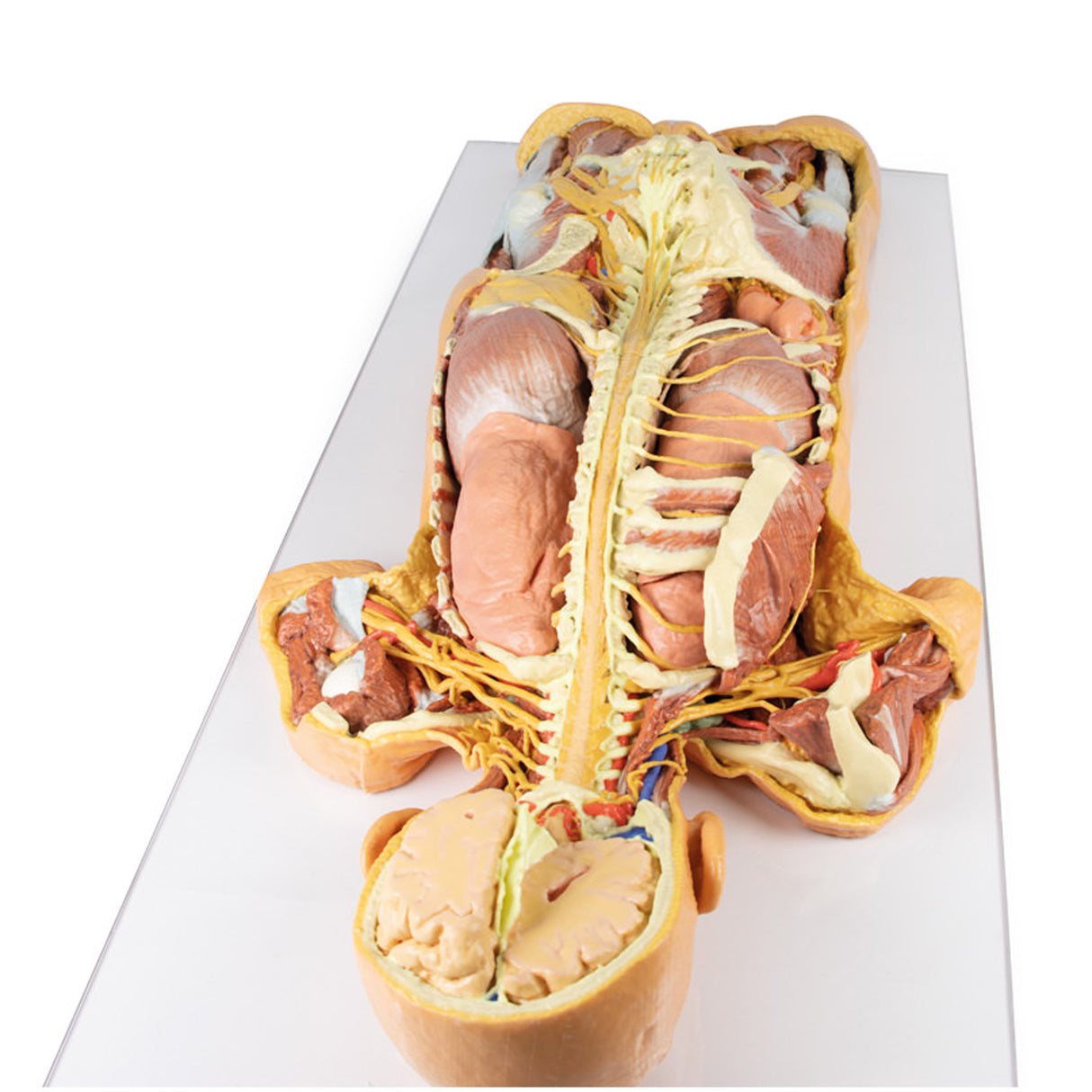 Nervous System Dissection (posterior view) | EZ-MP1400 | Sim & Skills Ltd