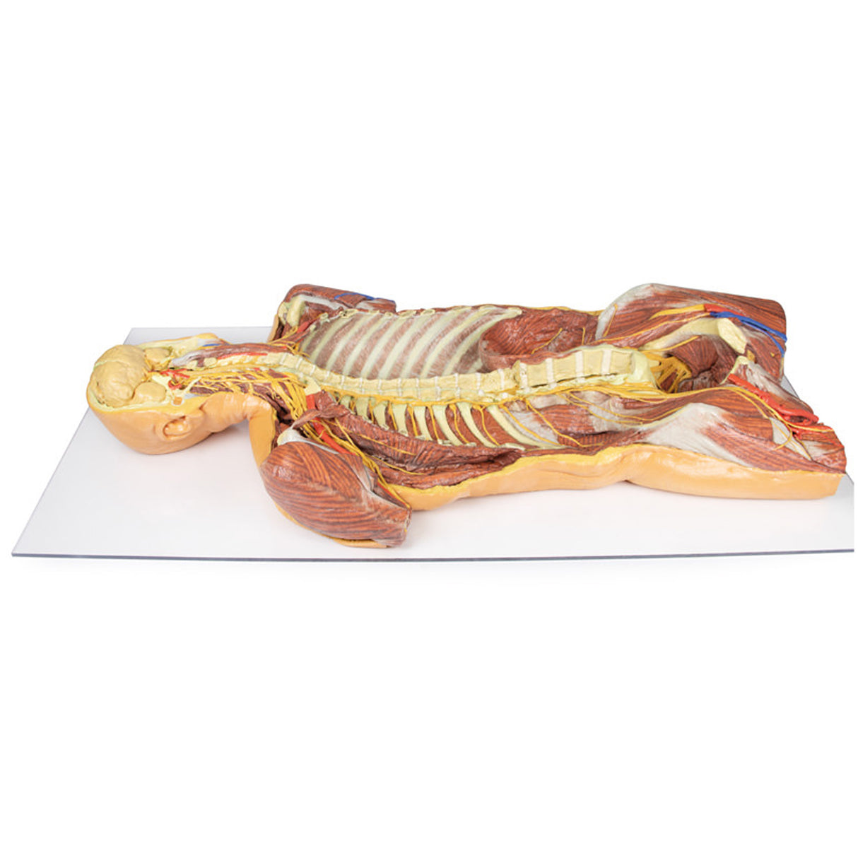 Posterior Body Wall / Ventral Deep Dissection | EZ-MP1410 | Sim & Skills Ltd