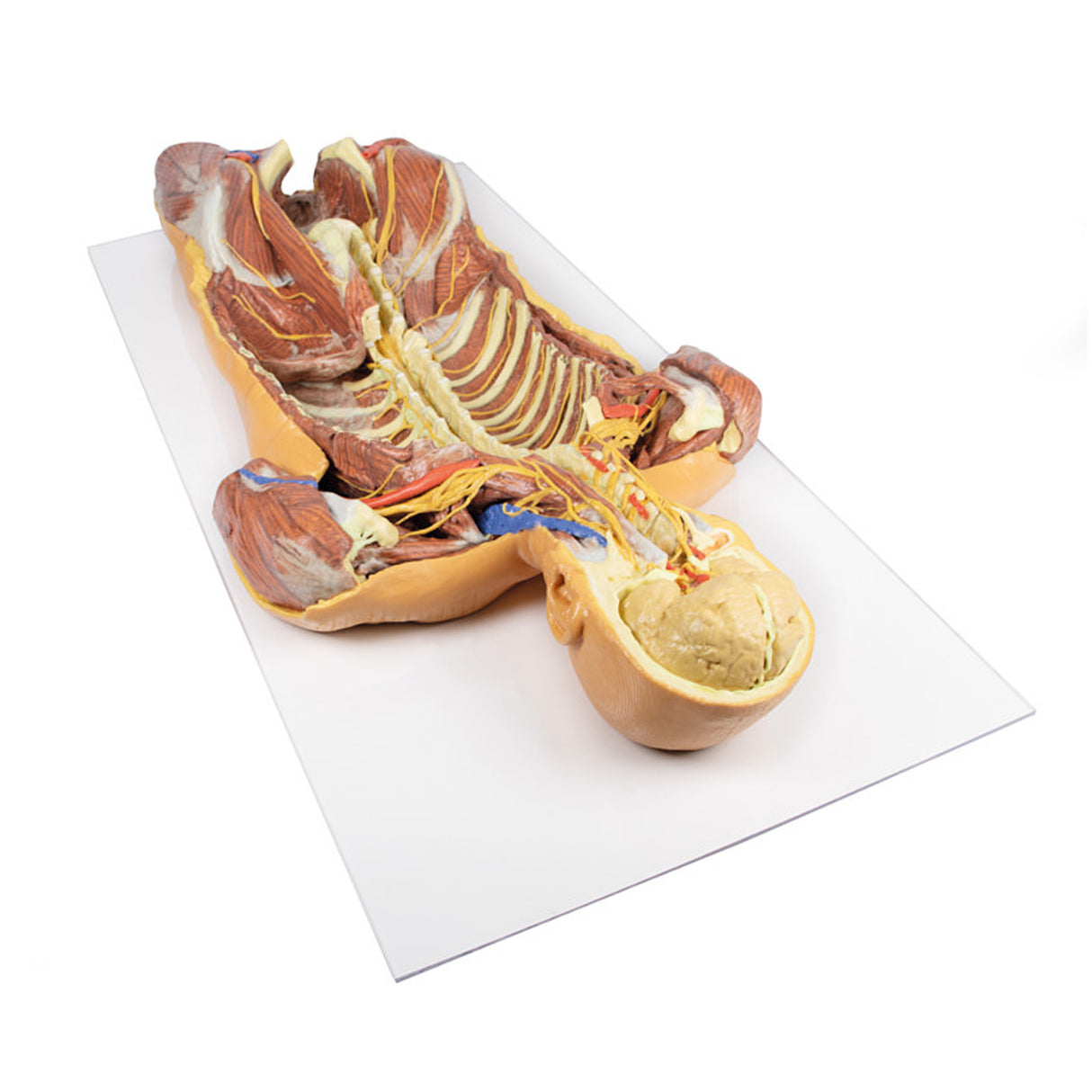 Posterior Body Wall / Ventral Deep Dissection | EZ-MP1410 | Sim & Skills Ltd
