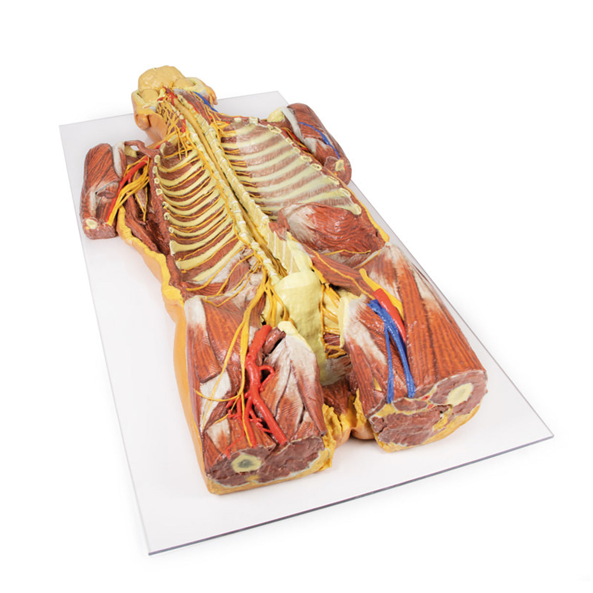Posterior Body Wall / Ventral Deep Dissection | EZ-MP1410 | Sim & Skills Ltd