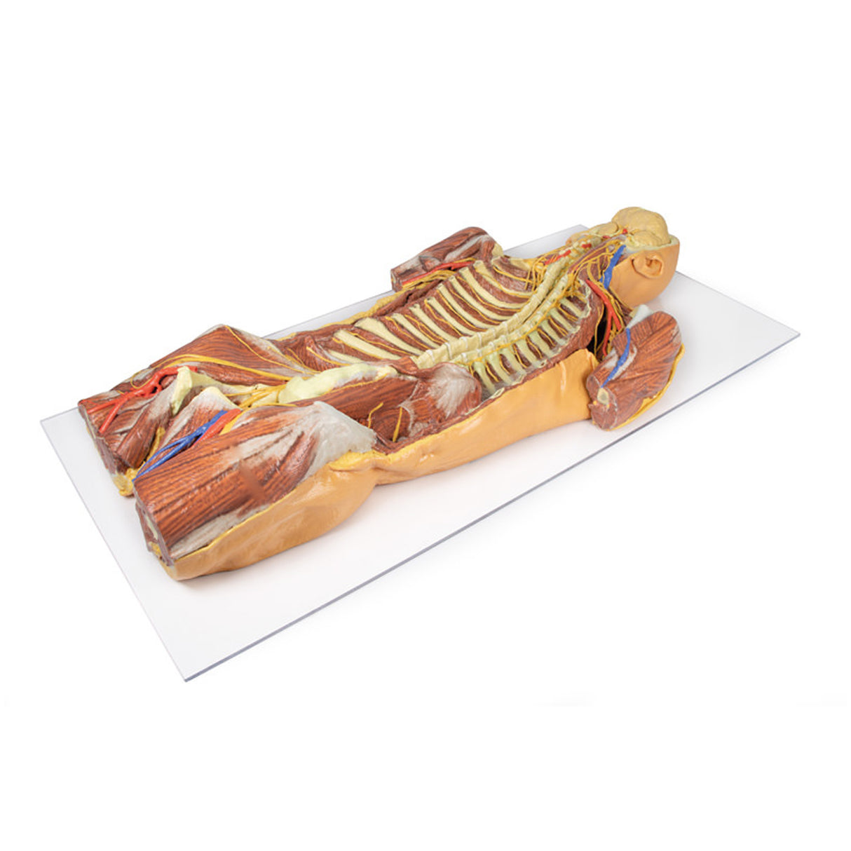Posterior Body Wall / Ventral Deep Dissection | EZ-MP1410 | Sim & Skills Ltd