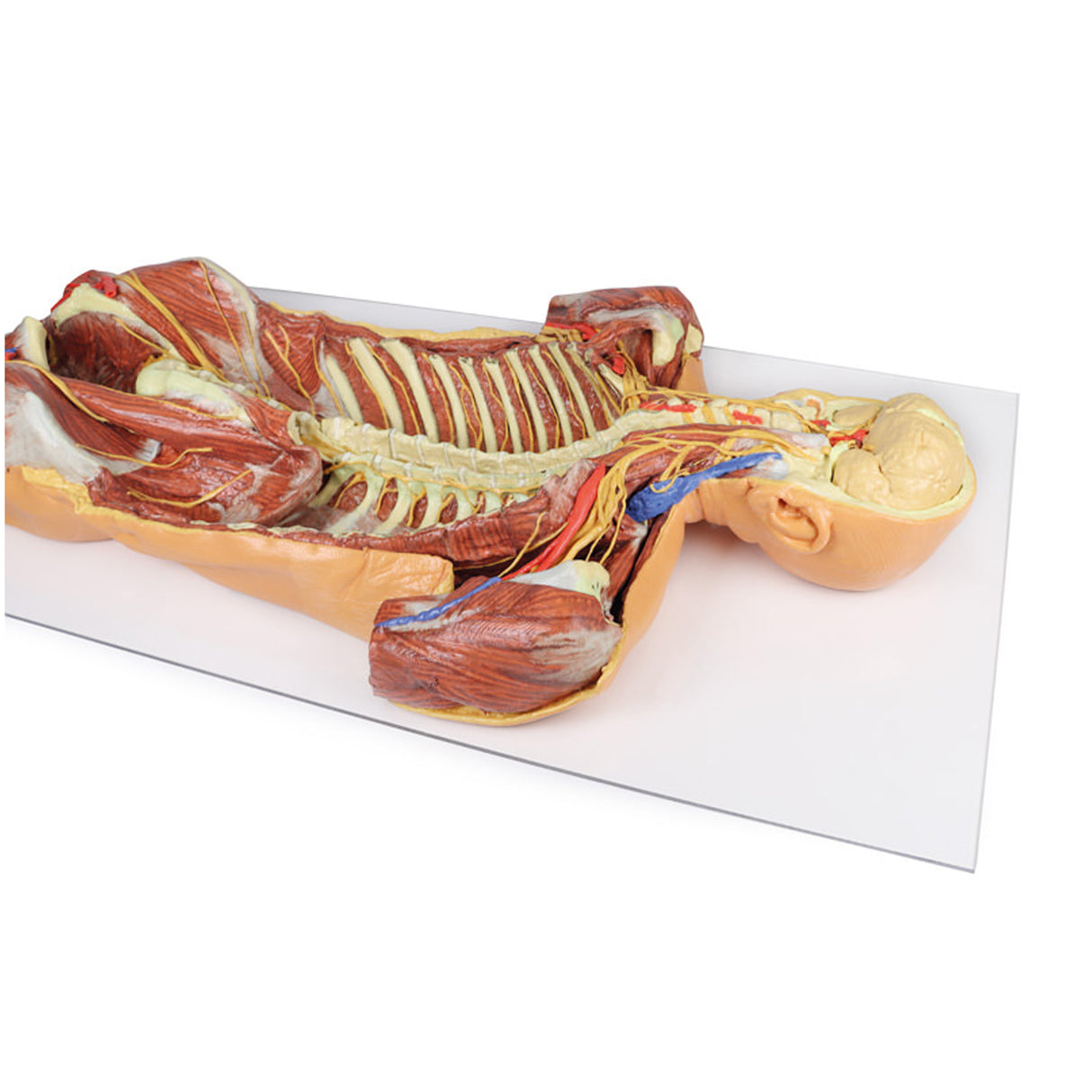 Posterior Body Wall / Ventral Deep Dissection | EZ-MP1410 | Sim & Skills Ltd