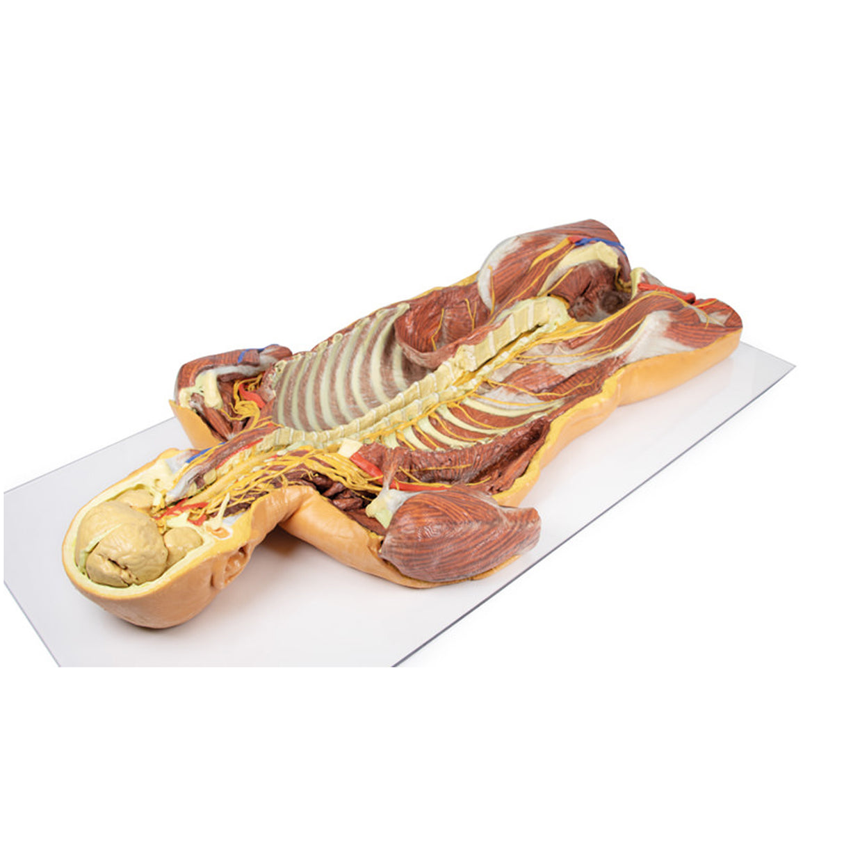 Posterior Body Wall / Ventral Deep Dissection | EZ-MP1410 | Sim & Skills Ltd
