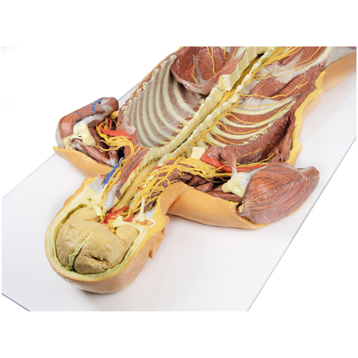Posterior Body Wall / Ventral Deep Dissection | EZ-MP1410 | Sim & Skills Ltd