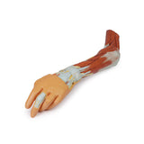 Upper Limb - elbow, forearm and hand | EZ-MP1510 | Sim & Skills Ltd 