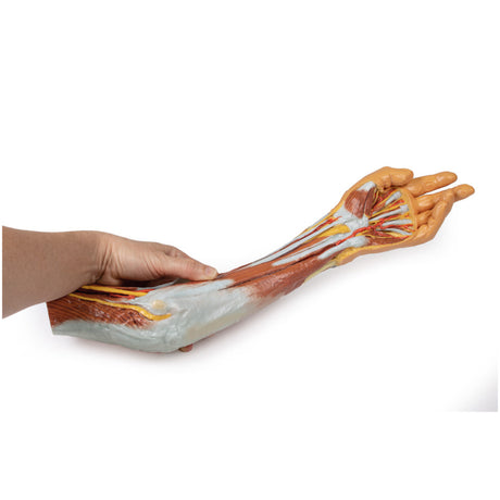 Upper Limb - elbow, forearm and hand | EZ-MP1510 | Sim & Skills Ltd 
