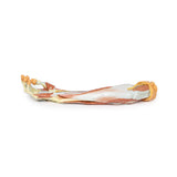 Deep upper limb and hand | EZ-MP1513 | Sim & Skills Ltd