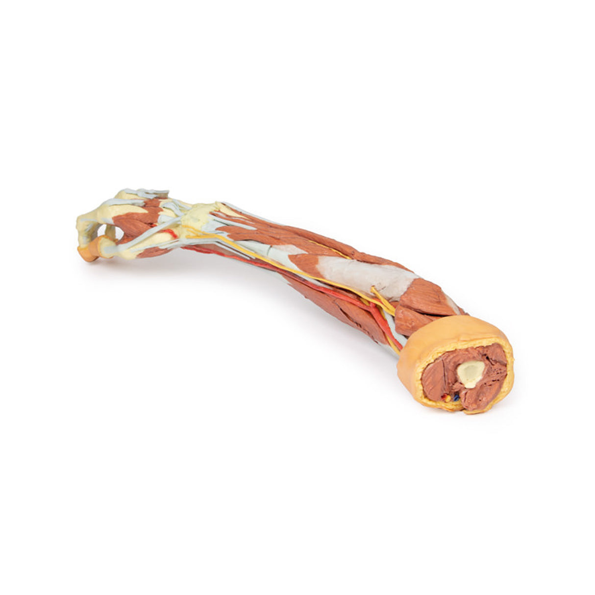 Deep upper limb and hand | EZ-MP1513 | Sim & Skills Ltd