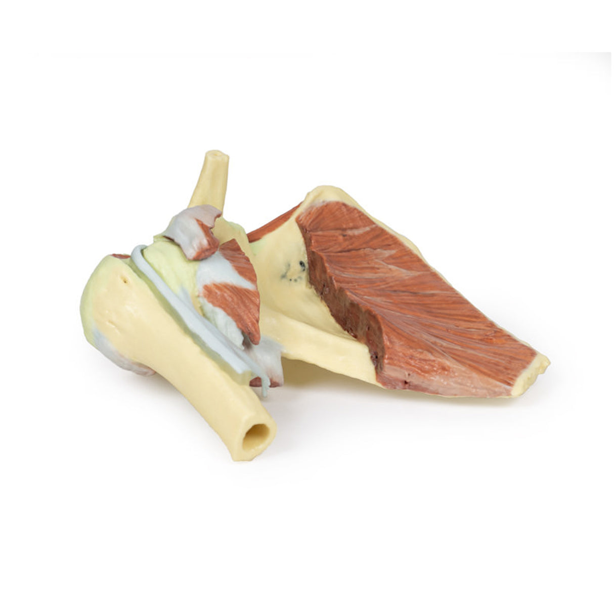 Shoulder - deep dissection of a right shoulder girdle, preserving a complete scapula, lateral clavicle, and proximal humerus | EZ-MP1527 | Sim & Skills Ltd