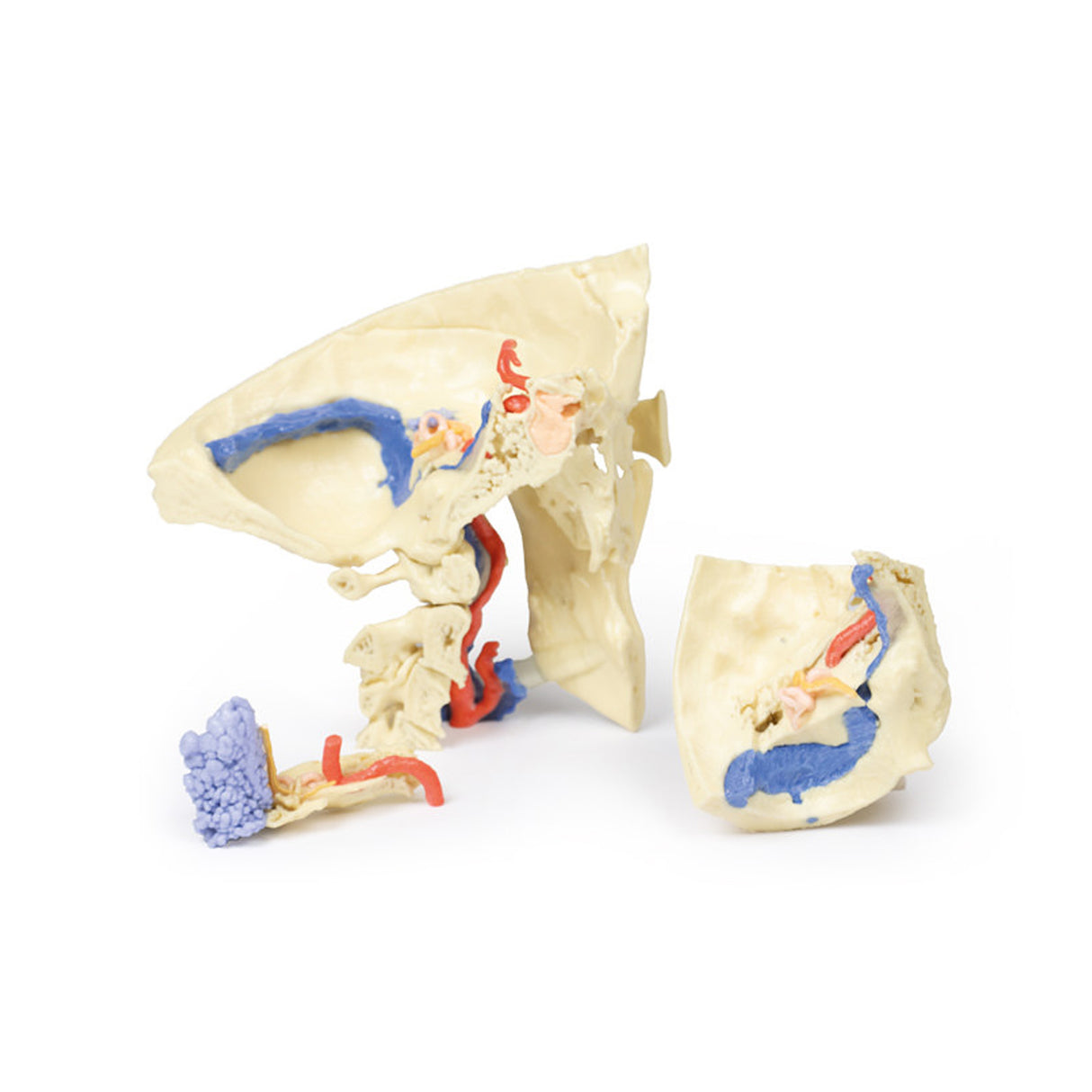 Temporal Bone Model, Set of 3 | EZ-MP1620 | Sim & Skills Ltd