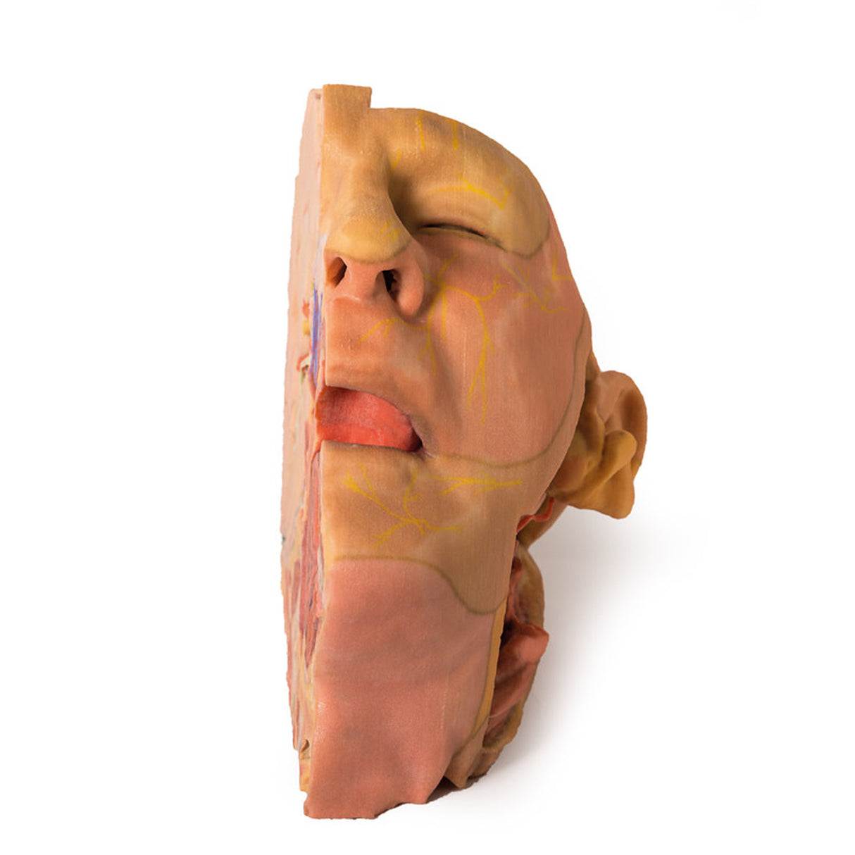 Head and Neck