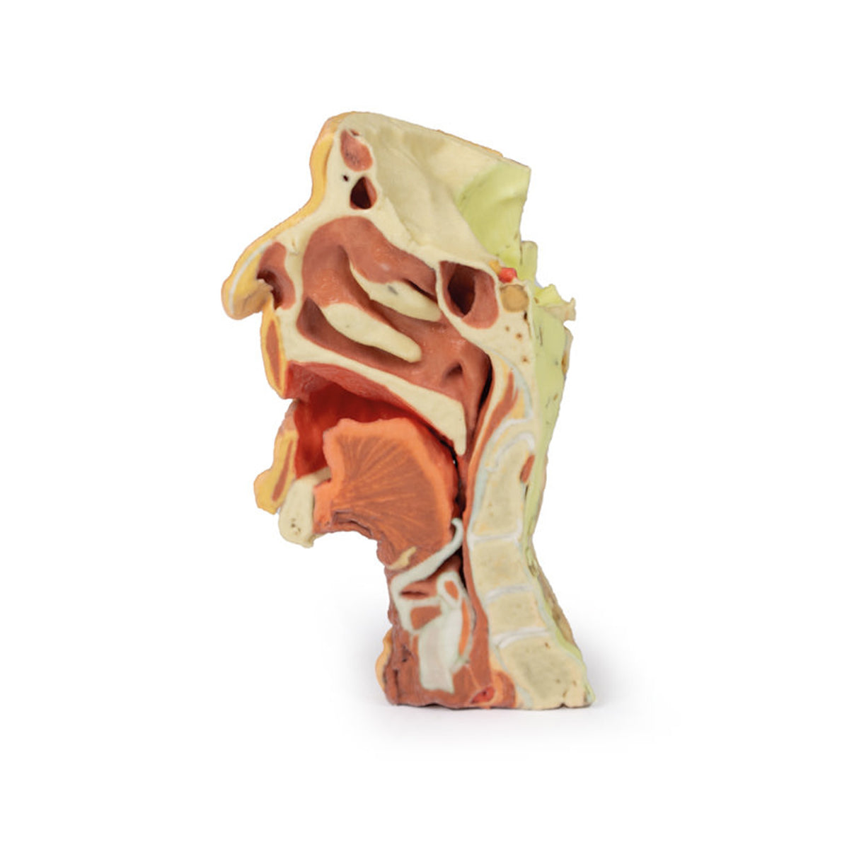 Deep face/Infratemporal fossa | EZ-MP1665 | Sim & Skills Ltd
