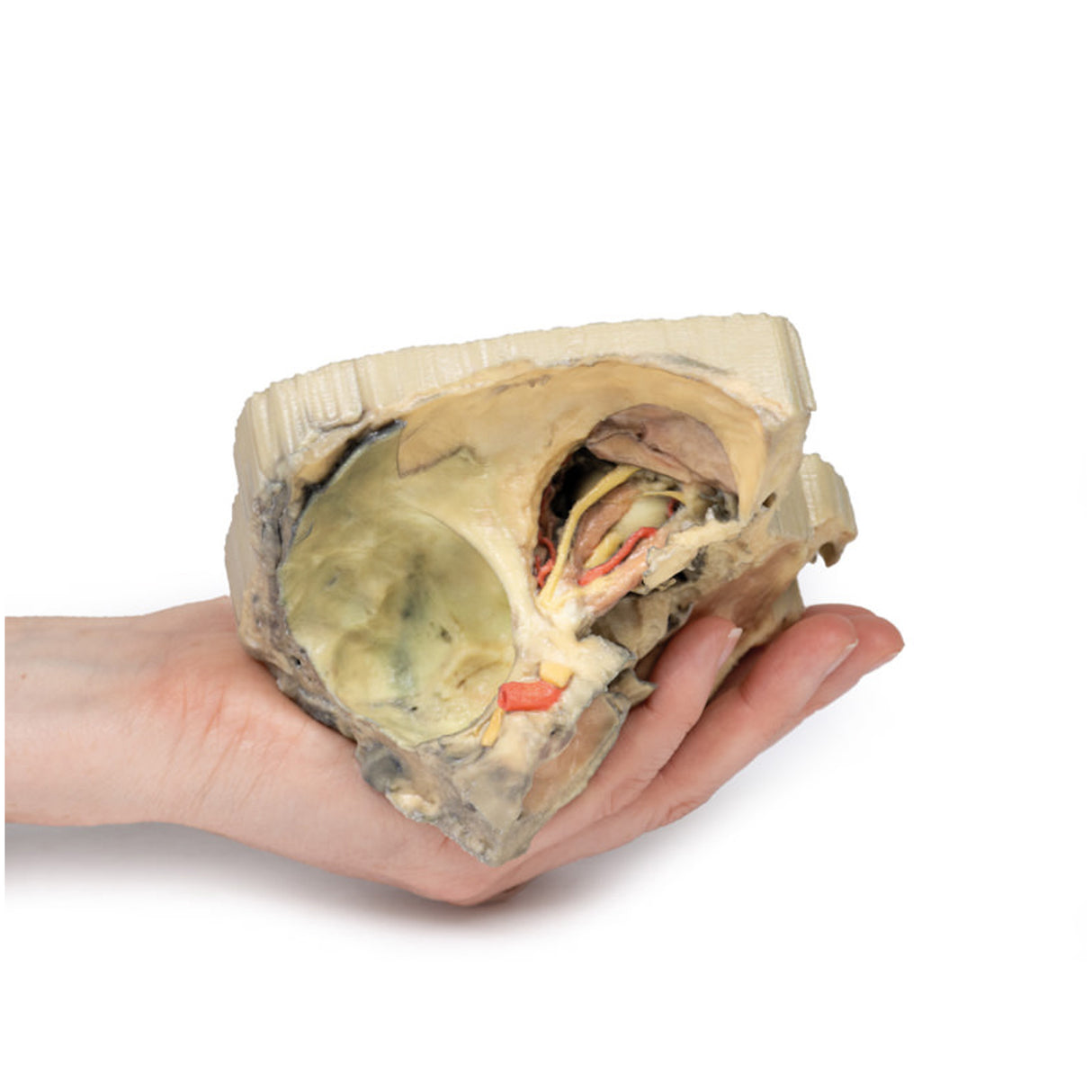 Medial Orbit | EZ-MP1685 | Sim & Skills Ltd