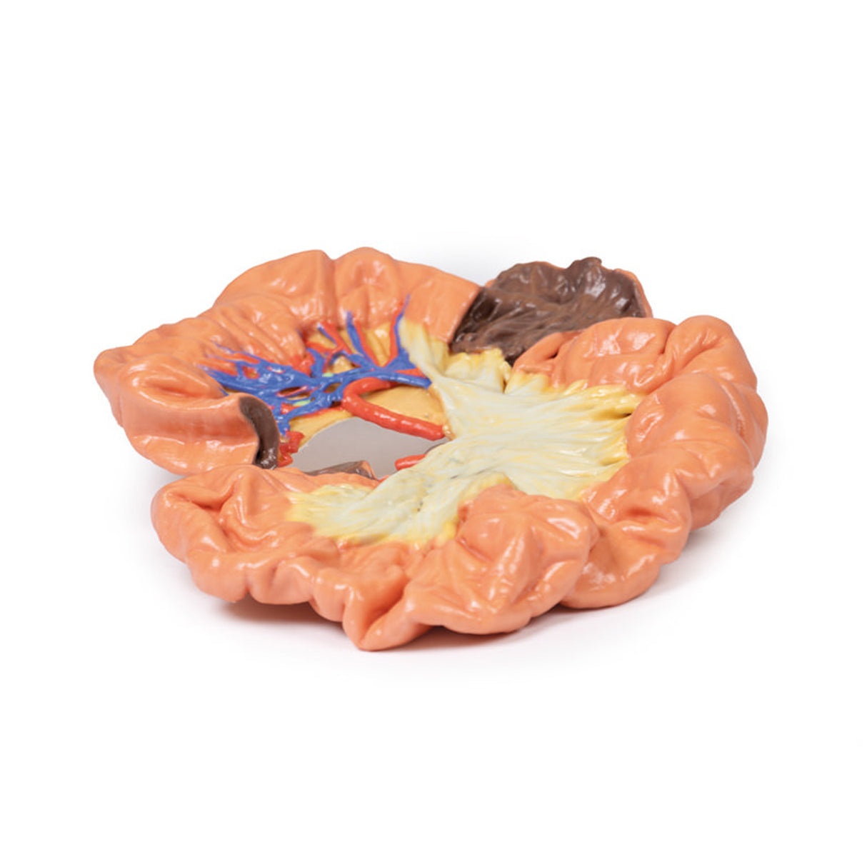 Bowel - Portion of Ileum | EZ-MP1725 | Sim & Skills Ltd