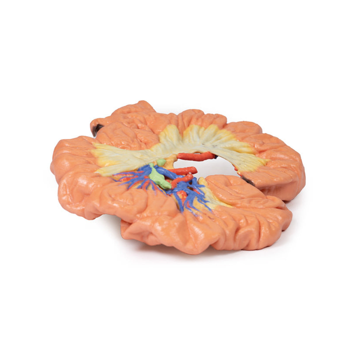 Bowel - Portion of Ileum | EZ-MP1725 | Sim & Skills Ltd