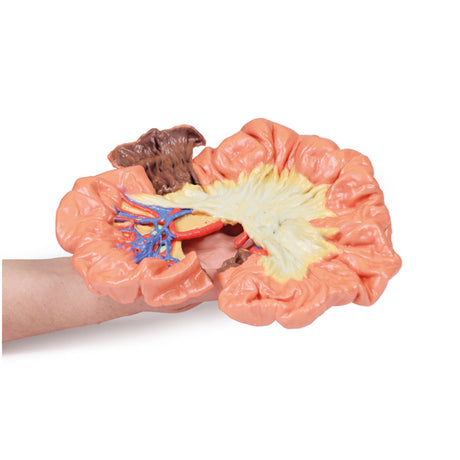 Bowel - Portion of Ileum | EZ-MP1725 | Sim & Skills Ltd