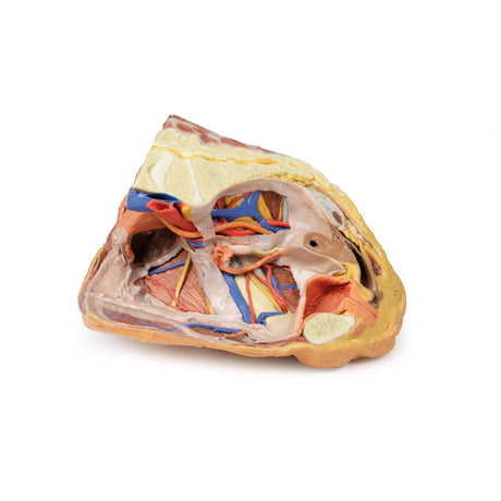 Female right pelvis superficial and deep structures | EZ-MP1783 | Sim & Skills Ltd