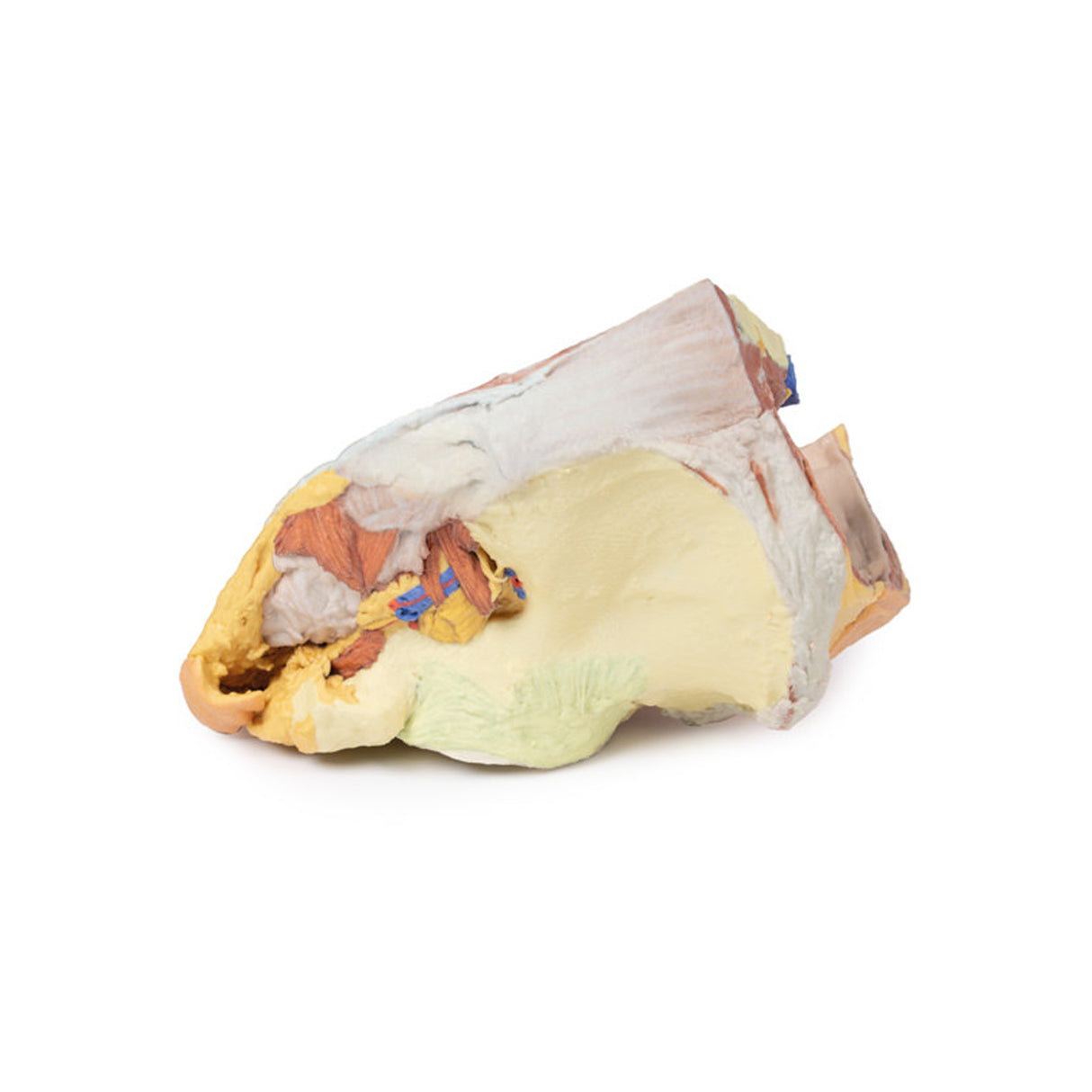 Female right pelvis superficial and deep structures | EZ-MP1783 | Sim & Skills Ltd