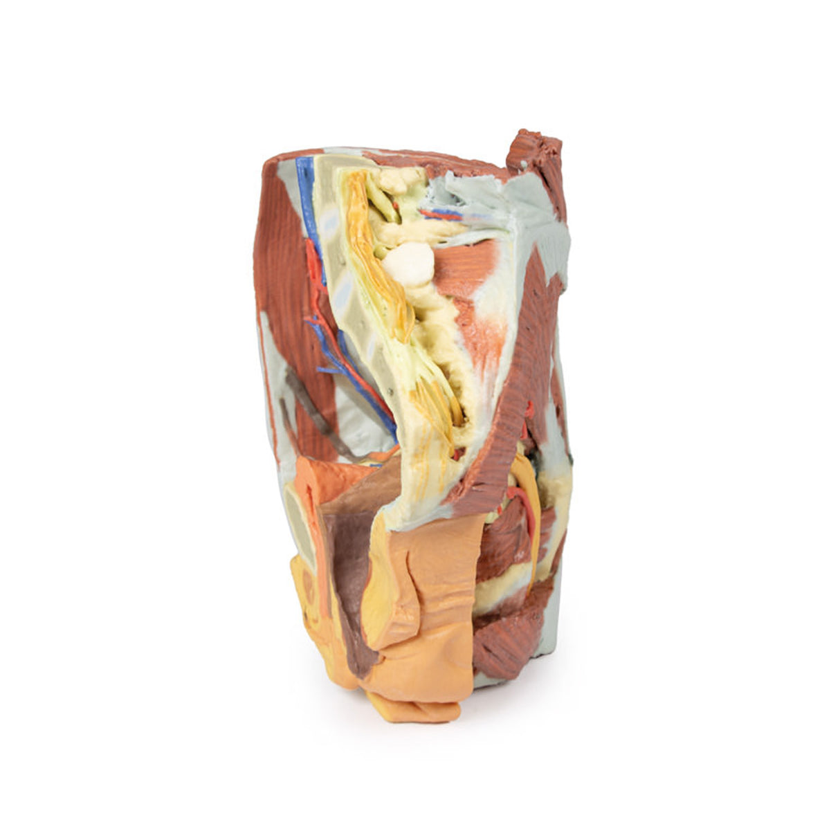 Female right pelvis | EZ-MP1785 | Sim & Skills Ltd