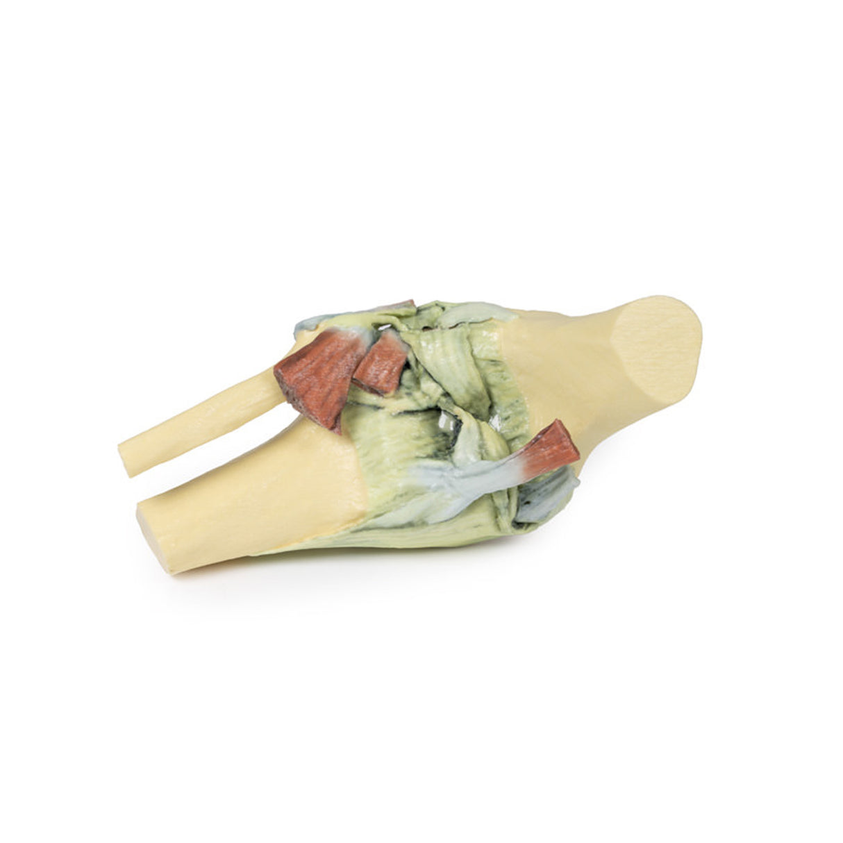 Knee Joint, flexed | EZ- MP1800 | Sim & Skills Ltd