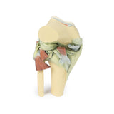 Knee Joint, flexed | EZ- MP1800 | Sim & Skills Ltd