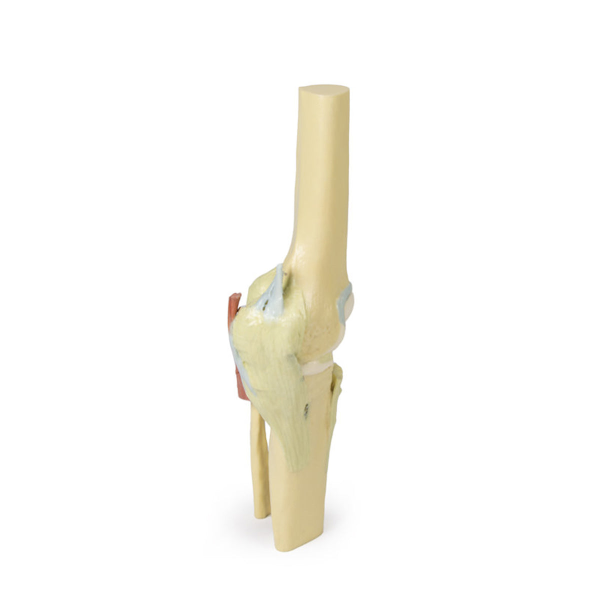 Knee Joint, extended | EZ-MP1805 | Sim & Skills Ltd