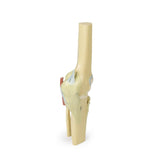 Knee Joint, extended | EZ-MP1805 | Sim & Skills Ltd