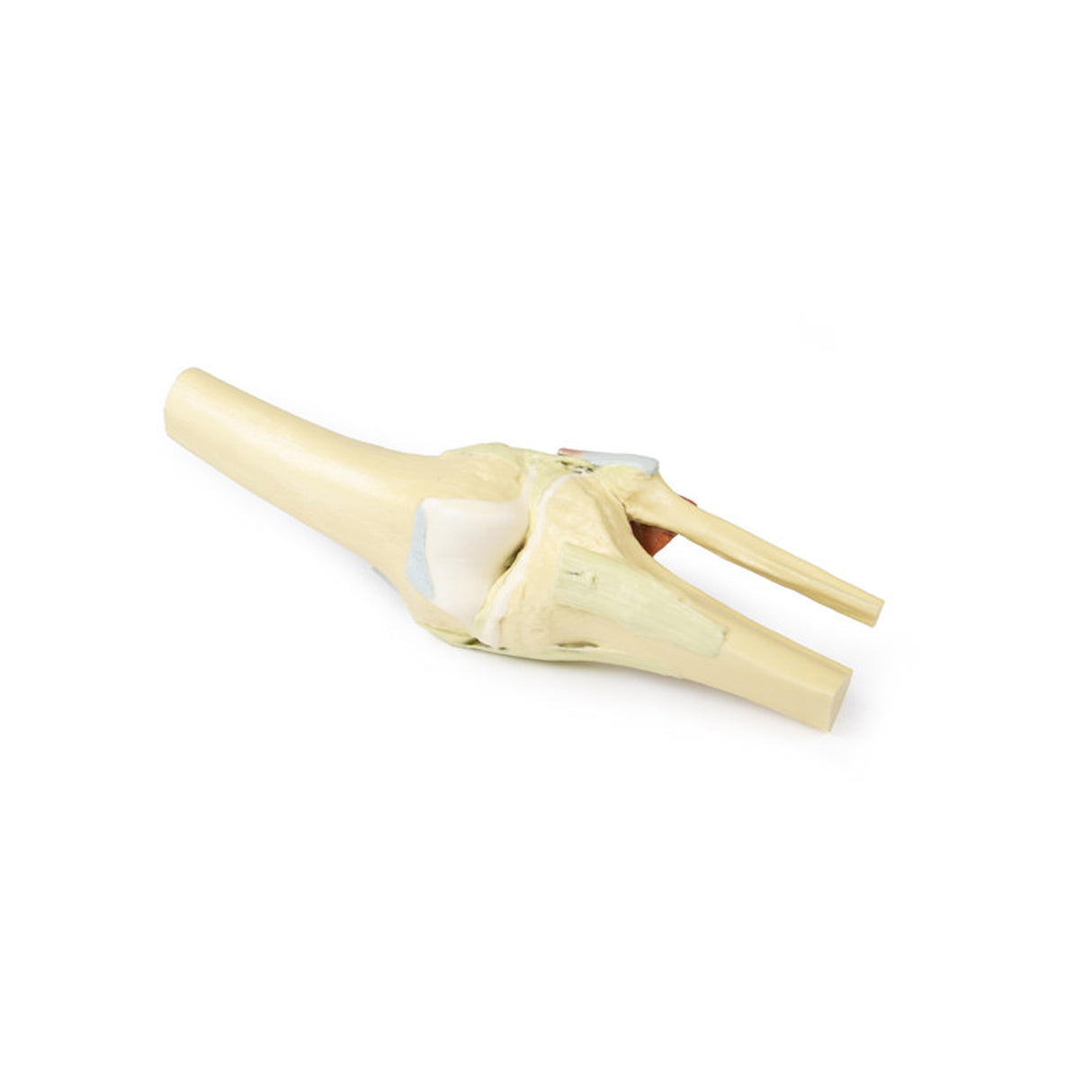 Knee Joint, extended | EZ-MP1805 | Sim & Skills Ltd