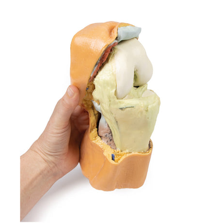Flexed knee joint deep dissection | EZ-MP1807 | SIm & Skills Ltd