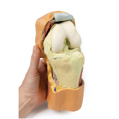 Flexed knee joint deep dissection | EZ-MP1807 | SIm & Skills Ltd