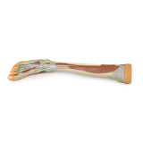 Lower Limb - deep dissection | EZ-MP1809 | Sim & Skills Ltd