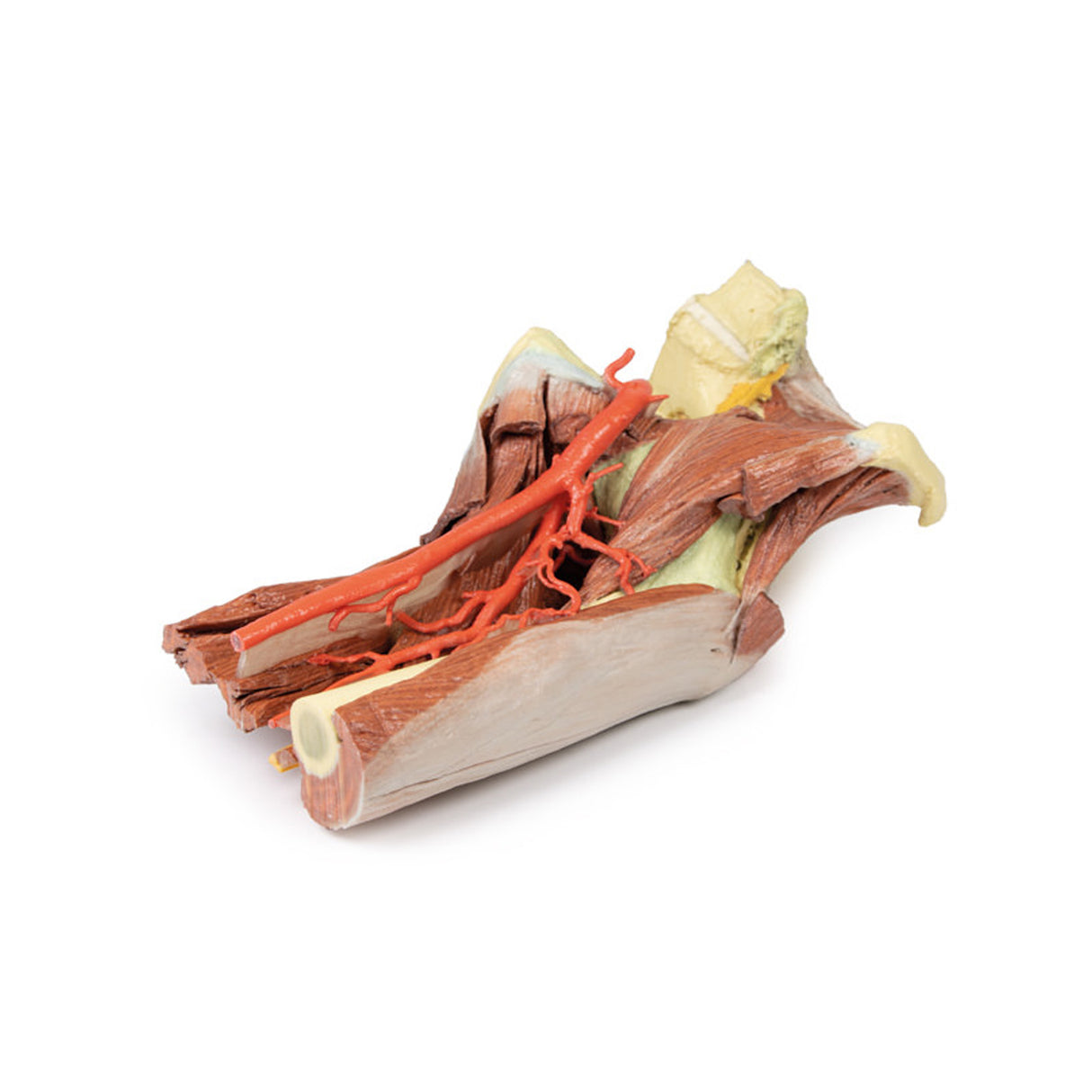 Lower Limb - deep dissection of a left pelvis and thigh | EZ-MP1813 | Sim & Skills Ltd