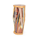 Popliteal Fossa | EZ-MP1830 | Sim & Skills Ltd