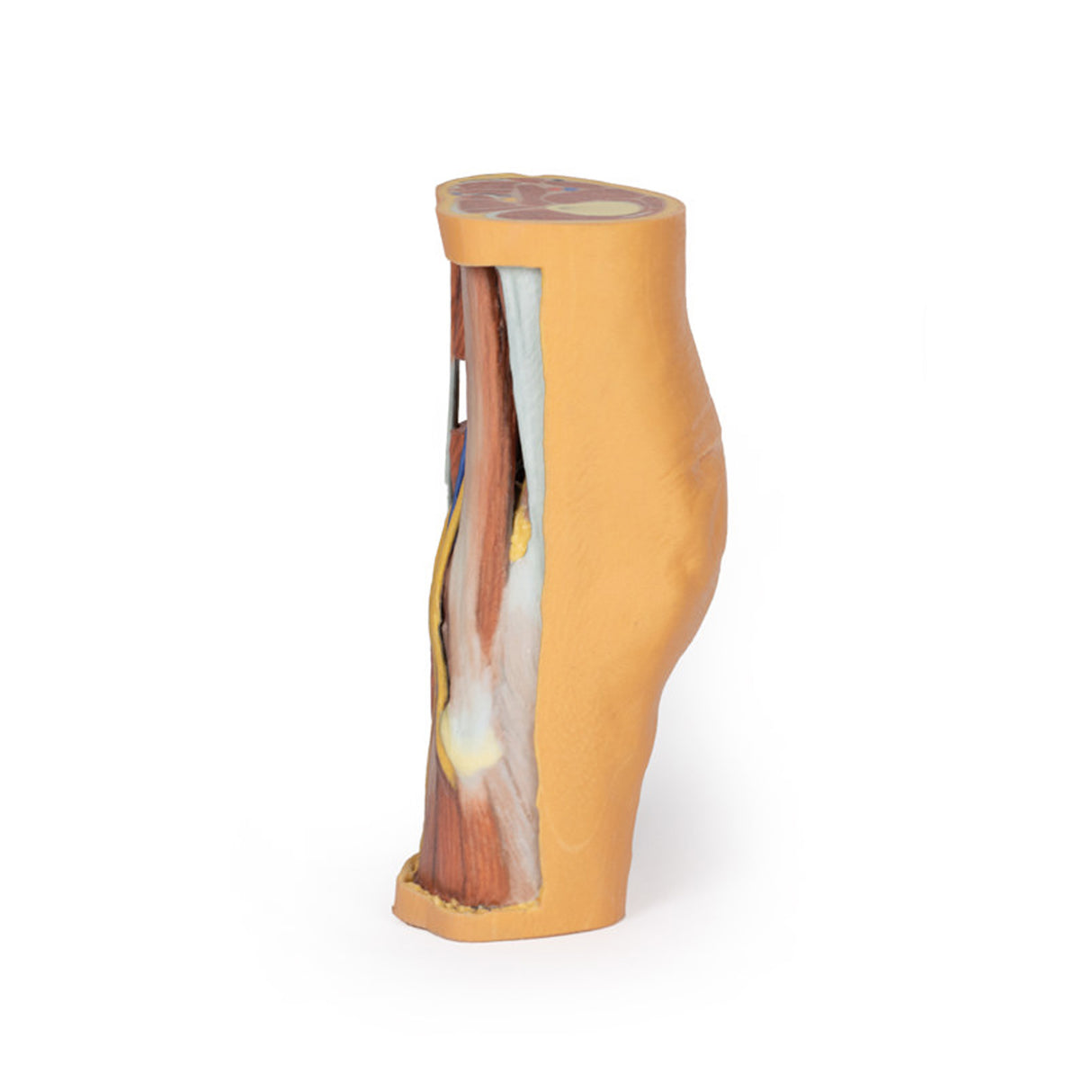 Popliteal Fossa | EZ-MP1830 | Sim & Skills Ltd