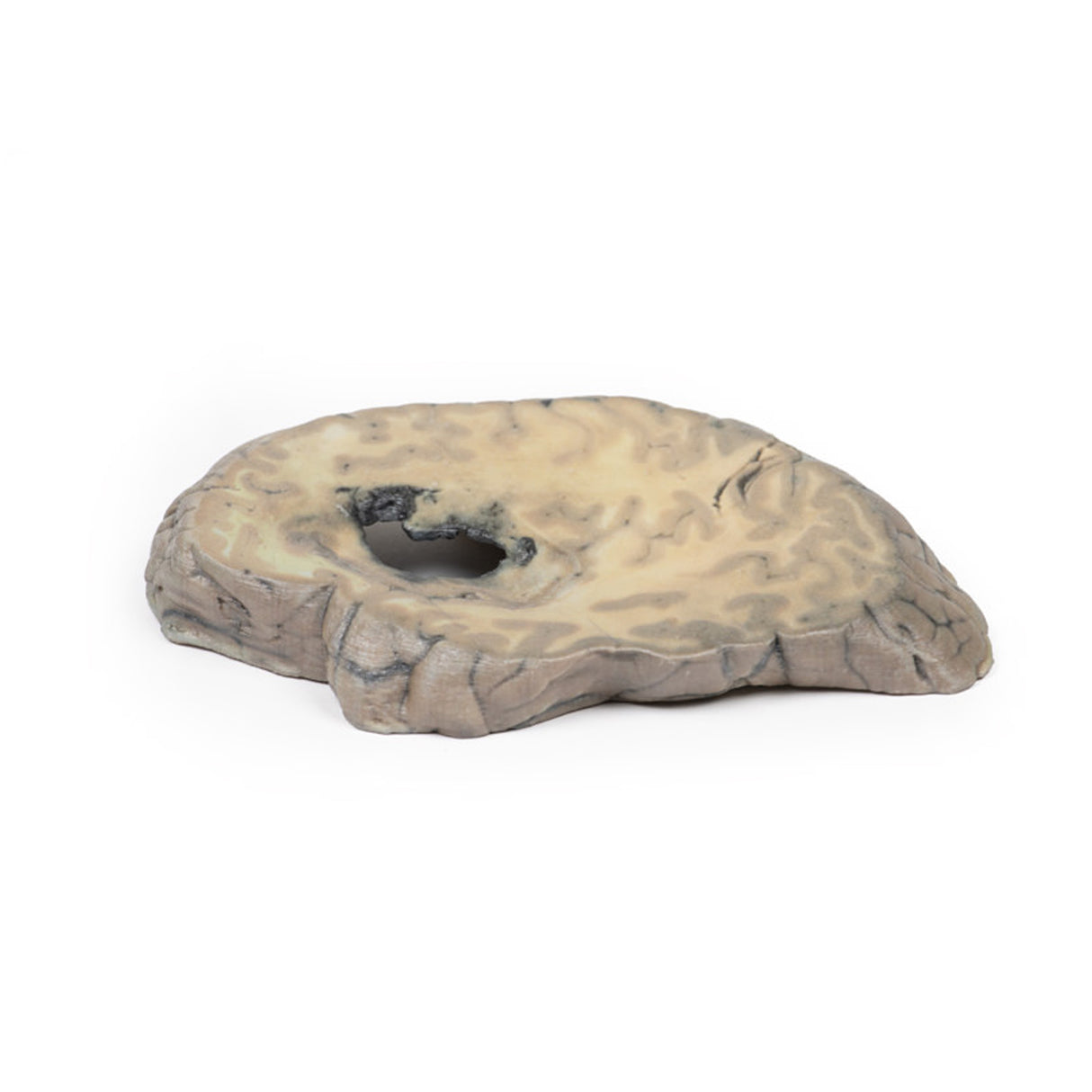 Cerebral Haemorrhage | EZ-MP2002 | Sim & Skills Ltd