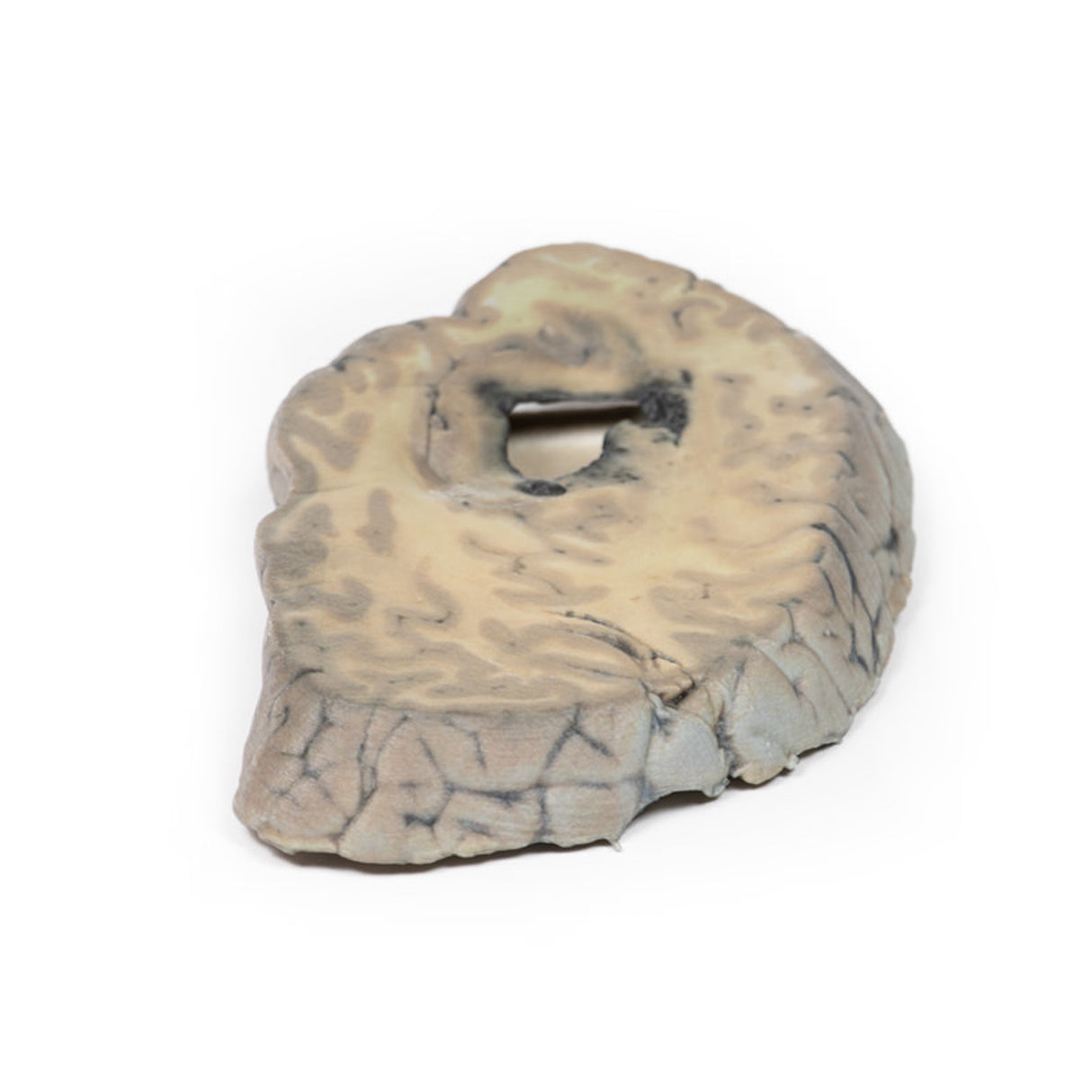 Cerebral Haemorrhage | EZ-MP2002 | Sim & Skills Ltd