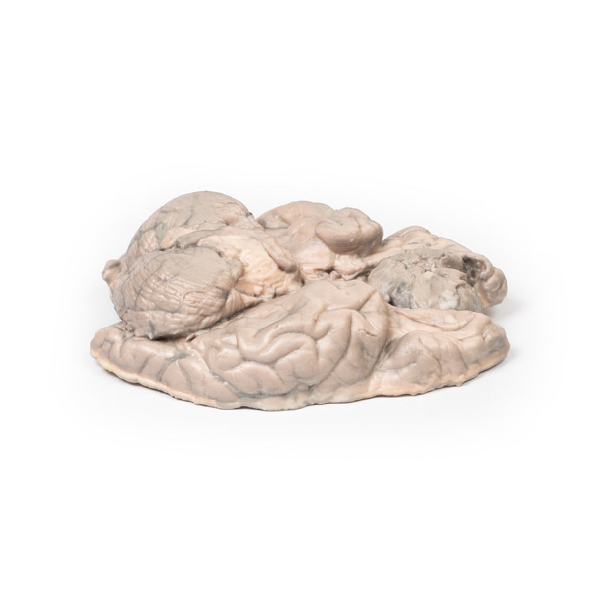 Meningioma | EZ-MP2004 | Sim & Skills Ltd
